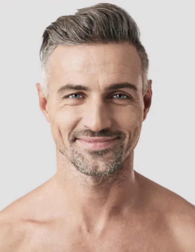 Chirurgiczny przeszczep włosów Kielce