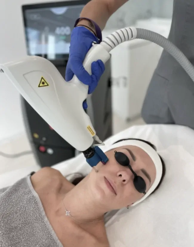 Laserowe usuwanie tatuażu, makijażu permanentnego Alma Clear Lift 532 nm