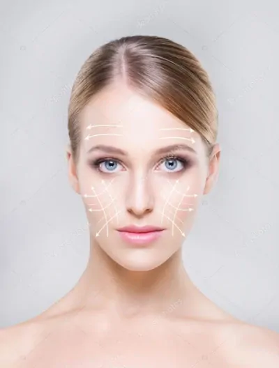 Nici liftingujące PDO