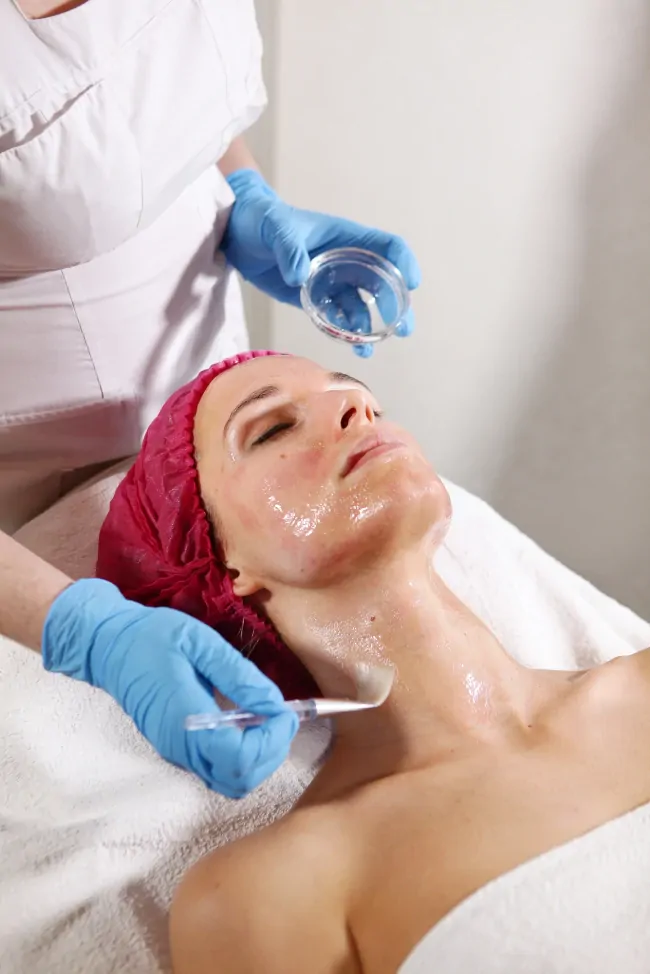 Mikroigłowa eksfoliacja skóry Easy TCA Pixel Peel Kielce