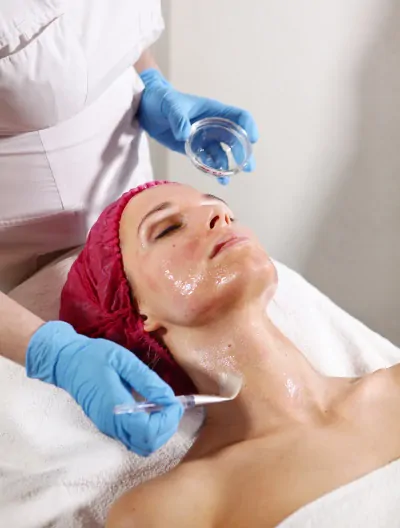 Mikroigłowa eksfoliacja skóry