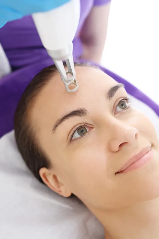 Frakcyjne mikronakłuwanie 4.0