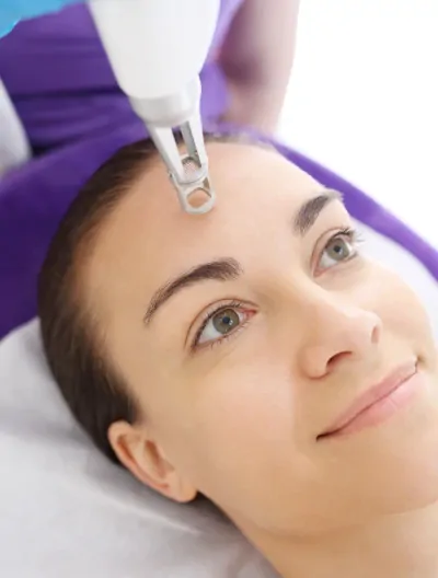 Frakcyjne mikronakłuwanie 4.0