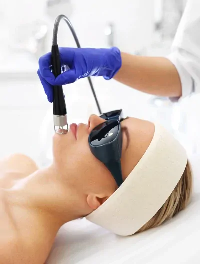 Radiofrekwencja mikroigłowa