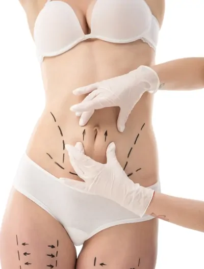 Komórki macierzyste z tkanki tłuszczowej