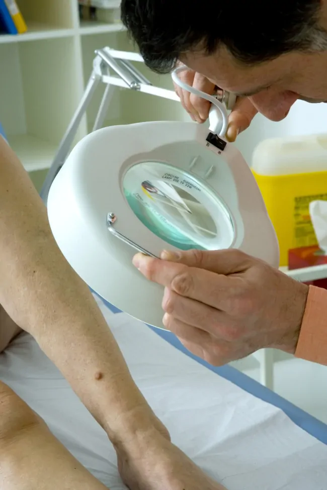 Badanie zmian skórnych pod dermatoskopem Kielce