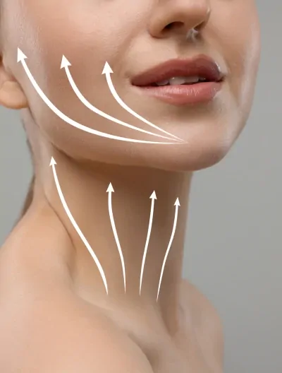 Lifting szyi DEEP PLANE NECK LIFT