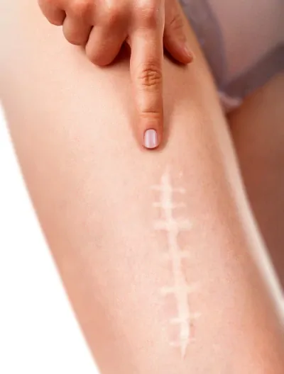 Blizny i zmiany skórne