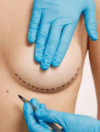 Powiększanie piersi implantami